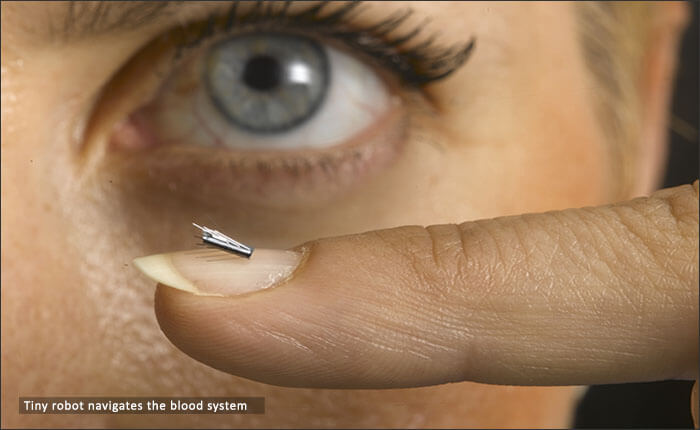 Tiny robot navigates the blood system
